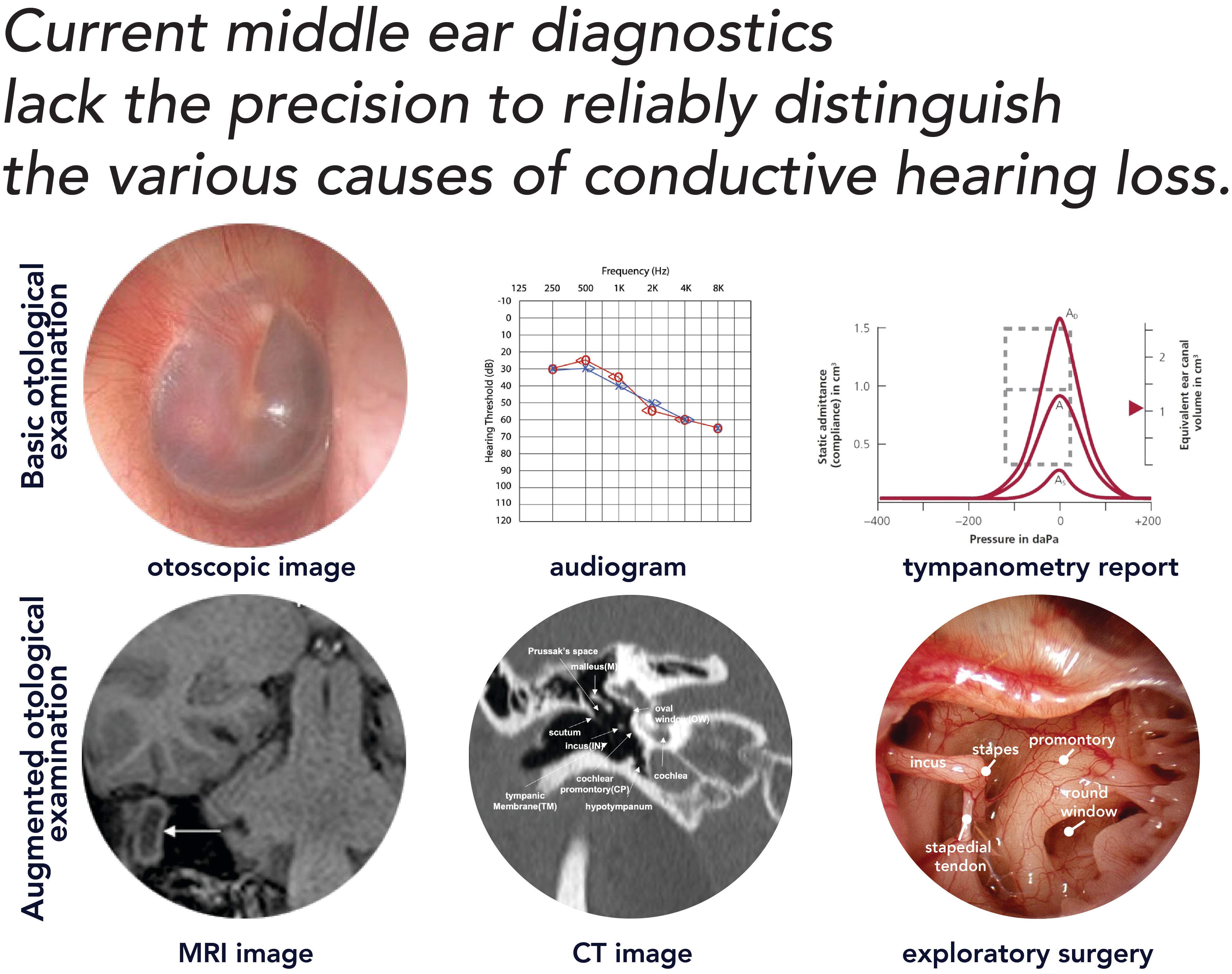 
              current otology diagnostics